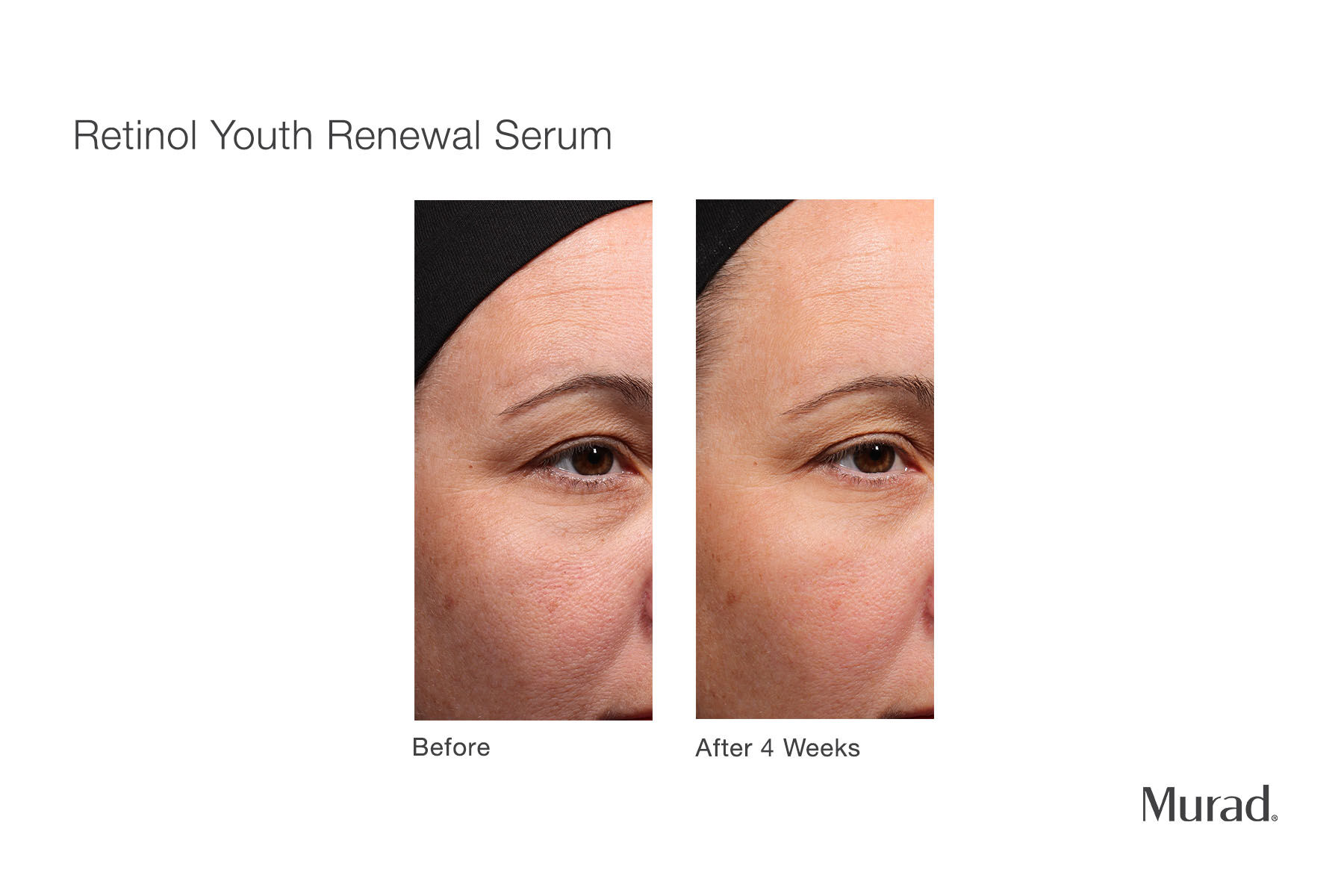 Retinol Youth Renewal Serum