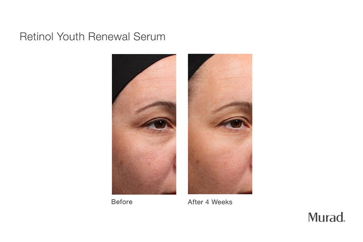 Retinol Youth Renewal Serum