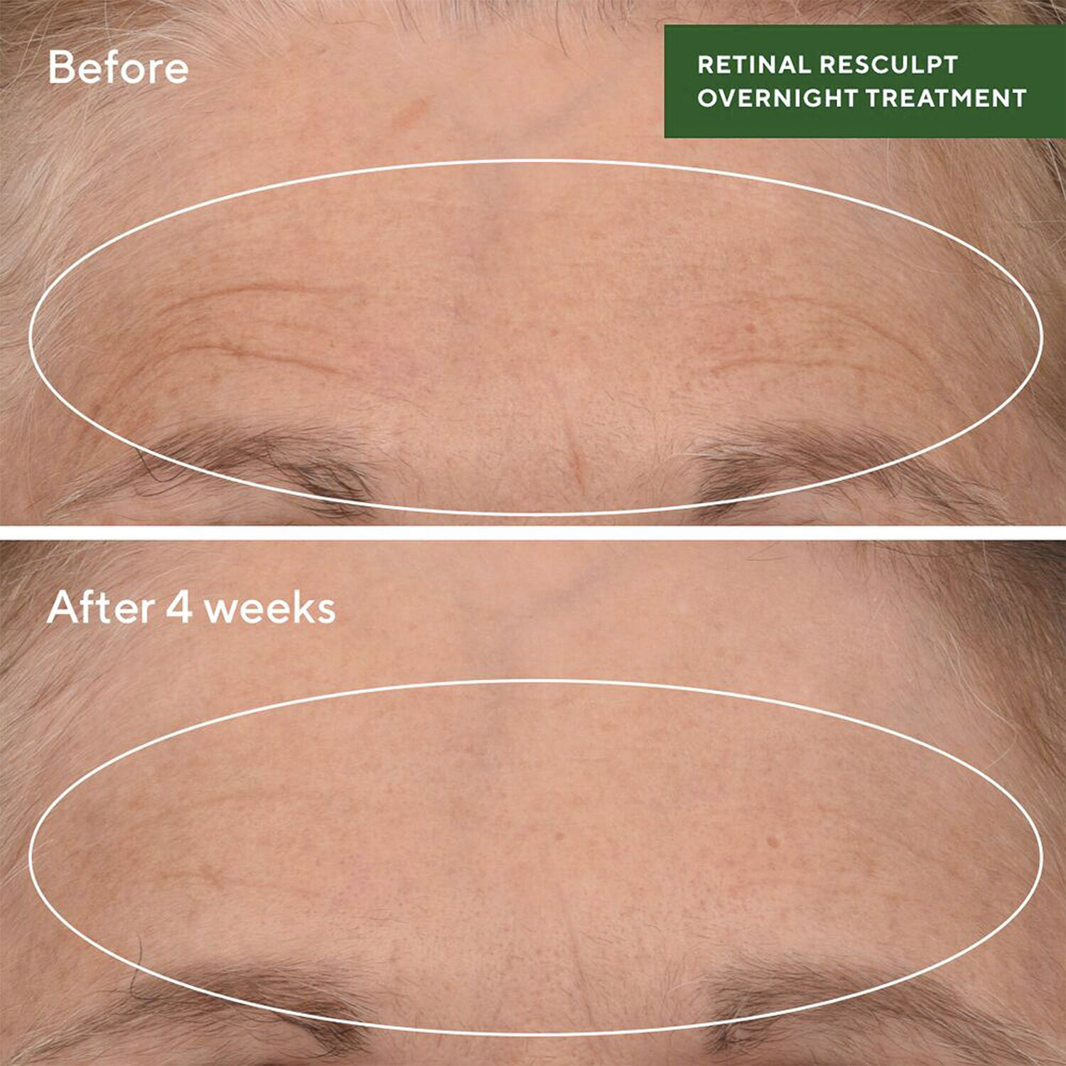 RETINAL RESCULPT OVERNIGHT TREATMEN