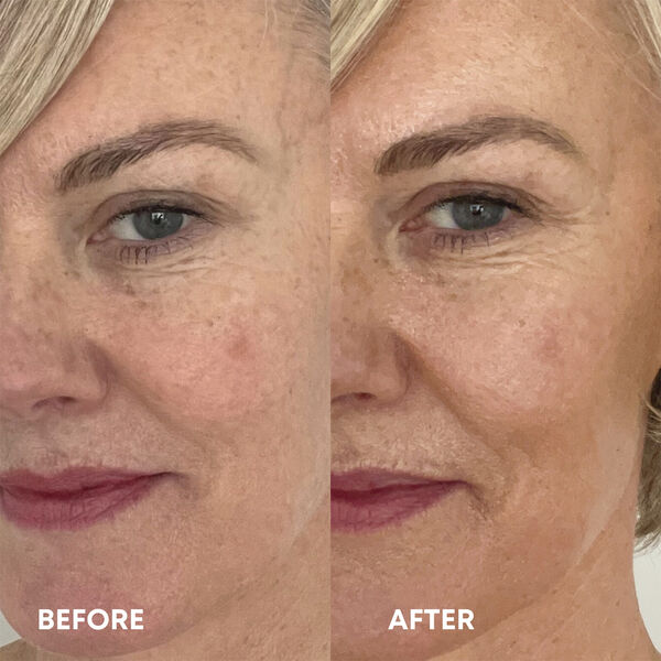 Beauty Blur Light 30 ml