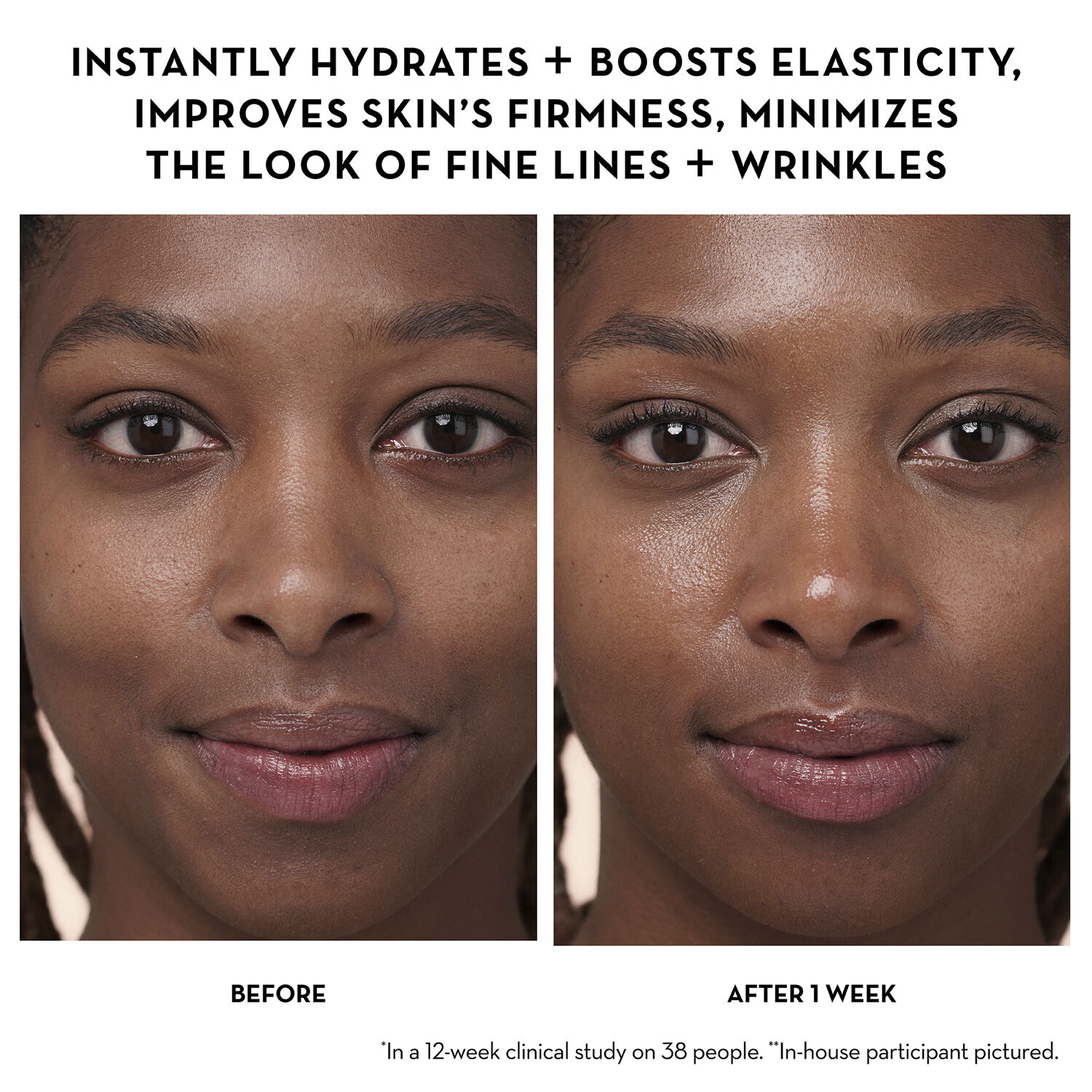 Dewtopia 5% Acid Firming natcreme