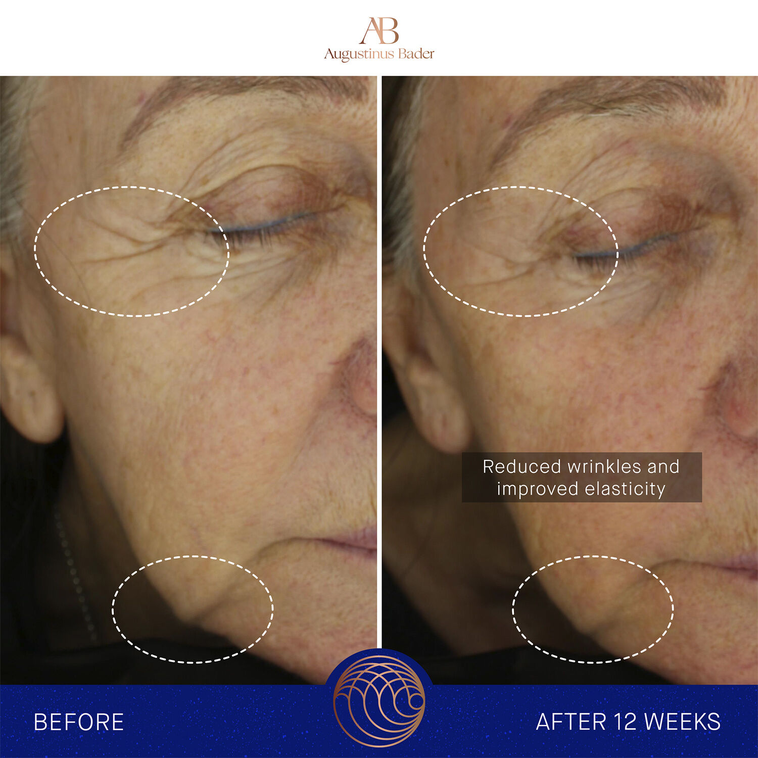 The Ultimate Sooting Cream