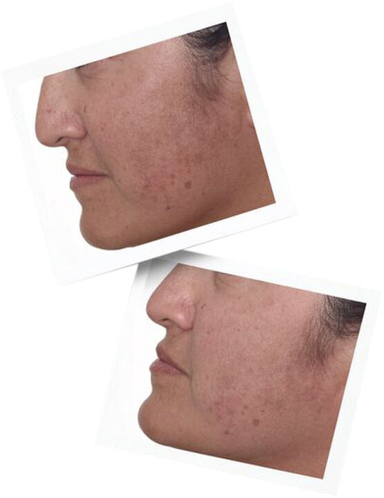 Rapid Dark Spot Correcting Serum