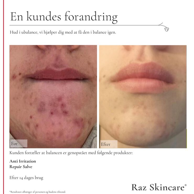 Raz Skincare Repair Salve Perfume Free 100 ml