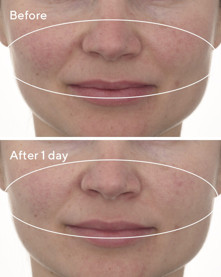 CELLULAR HYDRATION REPAIR MASK 80 ML