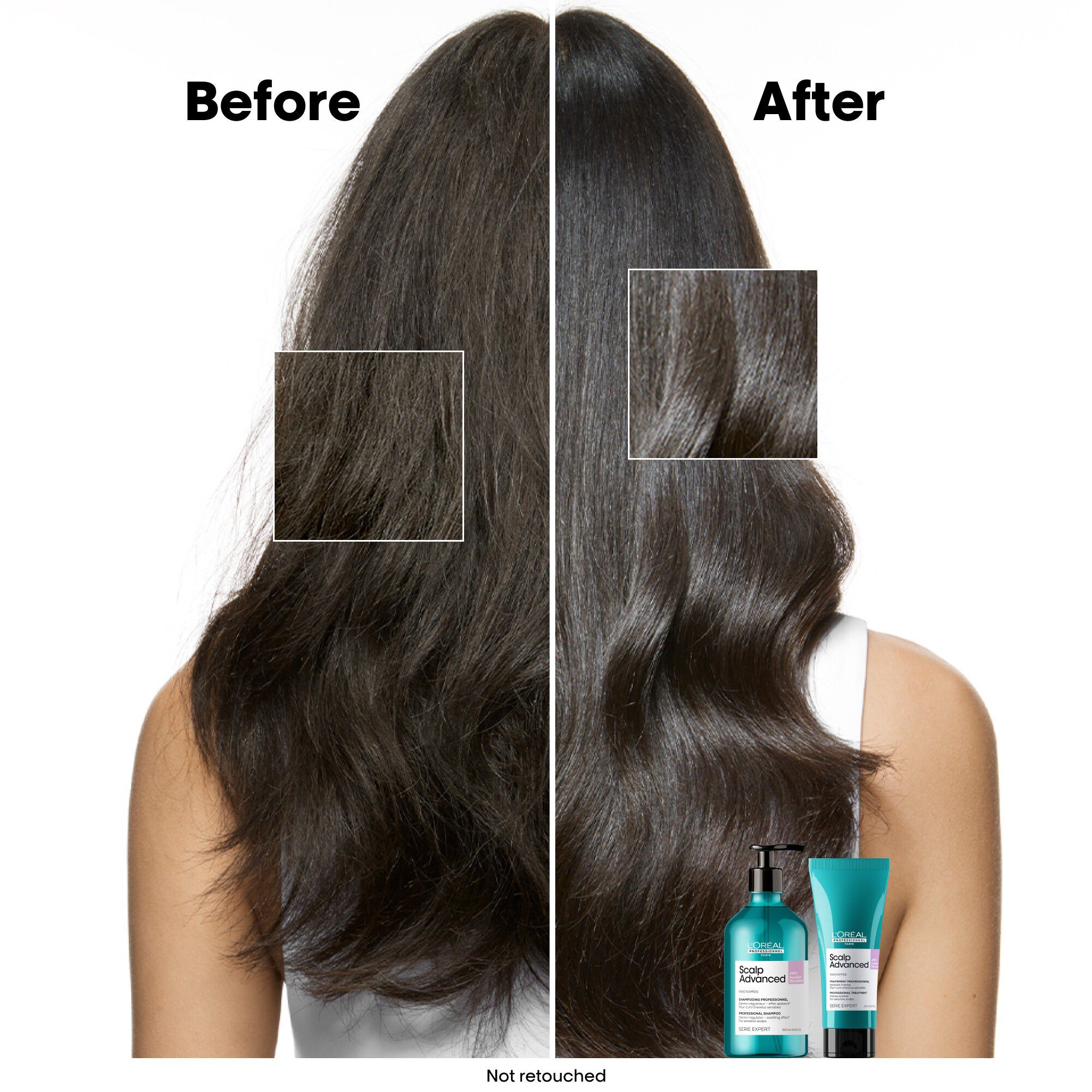 L'Or&eacute;al Professionnel Scalp Advanced Anti-Discomfort Treatment 200ml
