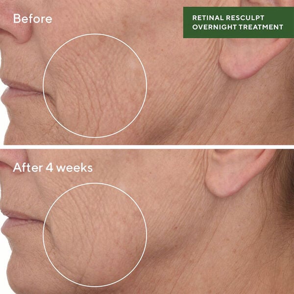 RETINAL RESCULPT OVERNIGHT TREATMEN