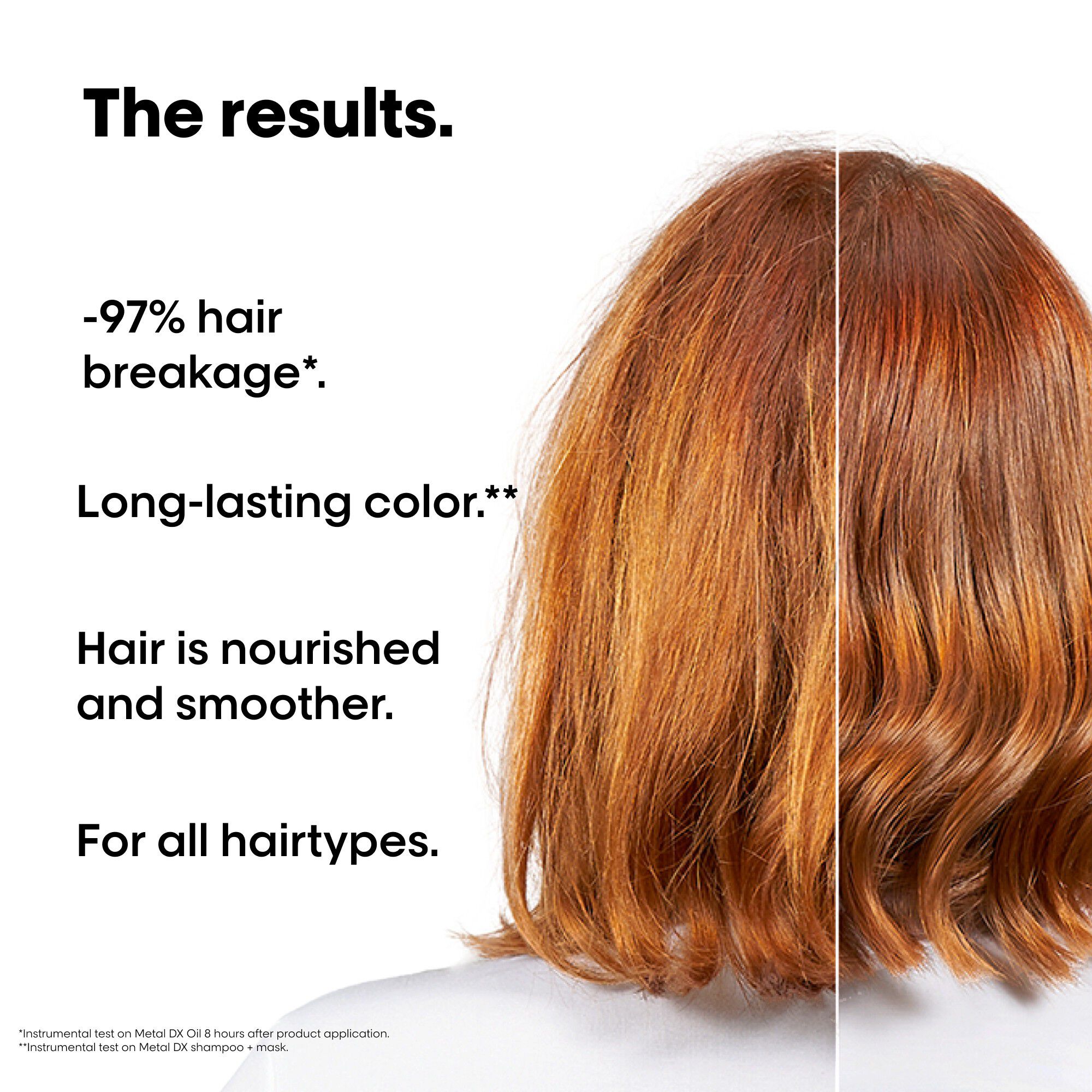 Metal DX Discovery Set Mini