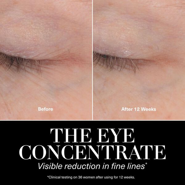 The Eye Concentrate