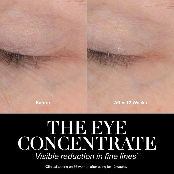 The Eye Concentrate