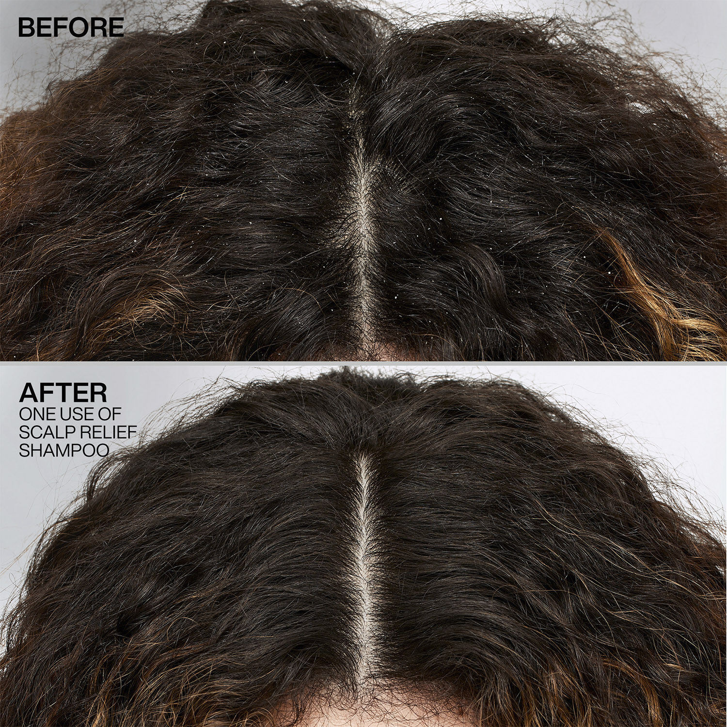 Scalp Relief Dandruff Control Shampoo