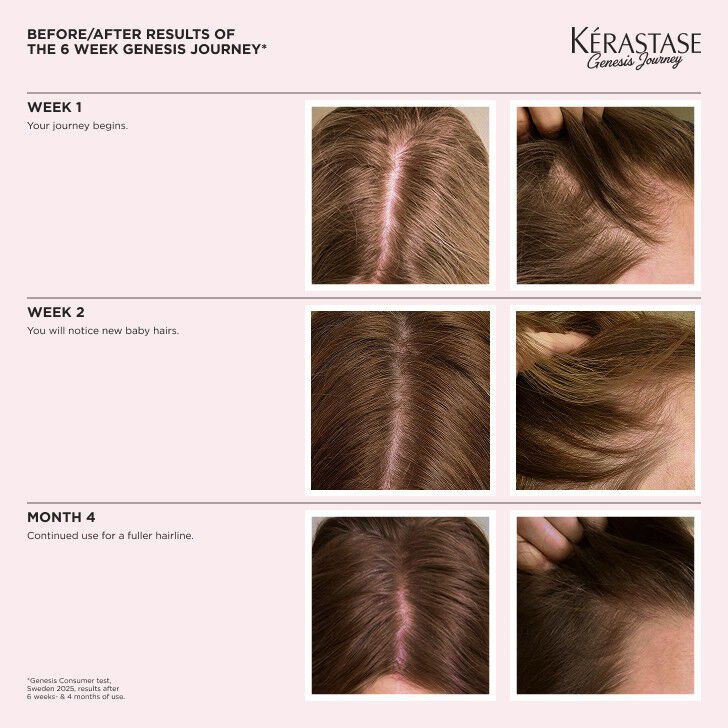 Genesis Serum Anti-Chute Fortifiant