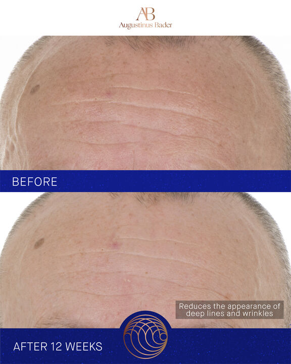 The Retinol Serum 15ml Nomade ROW