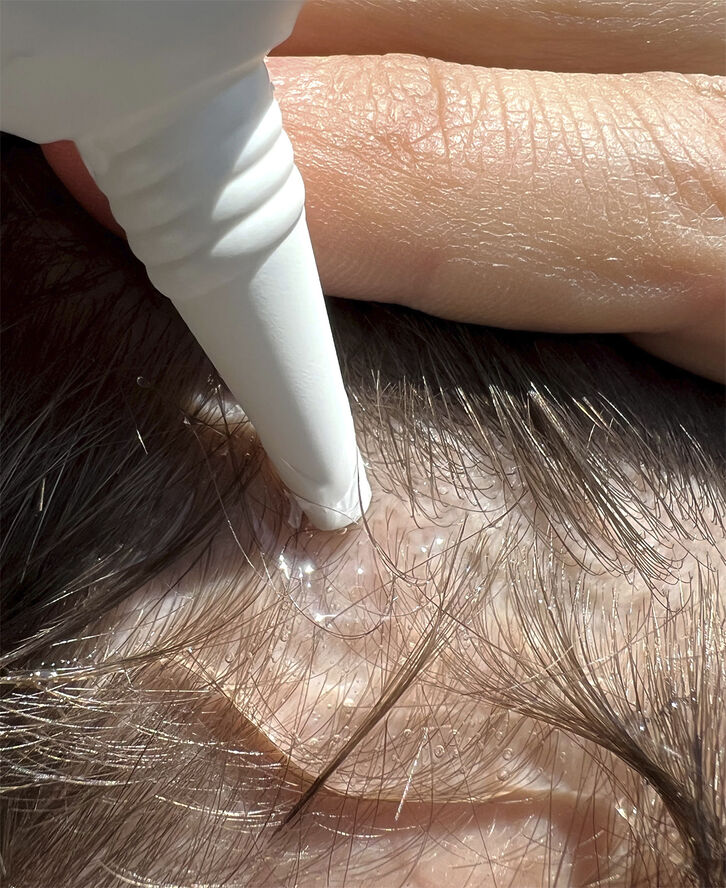 Hair Activator - Hårstimulerende serum