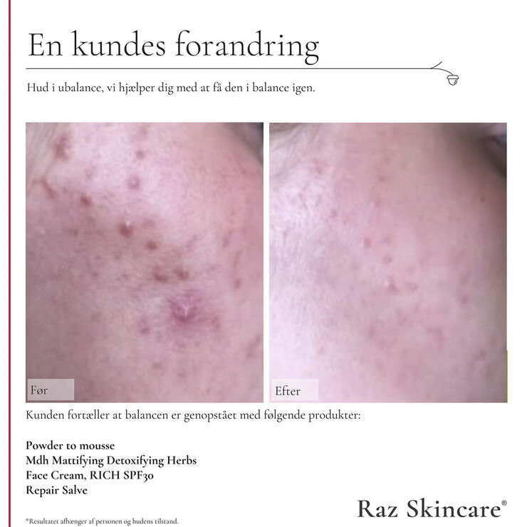 Raz Skincare Face Cream, RICH 50 ml