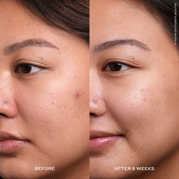 OLE HENRIKSEN TRANSFORM Dewtopia 20% Acid Treatment 30 ML