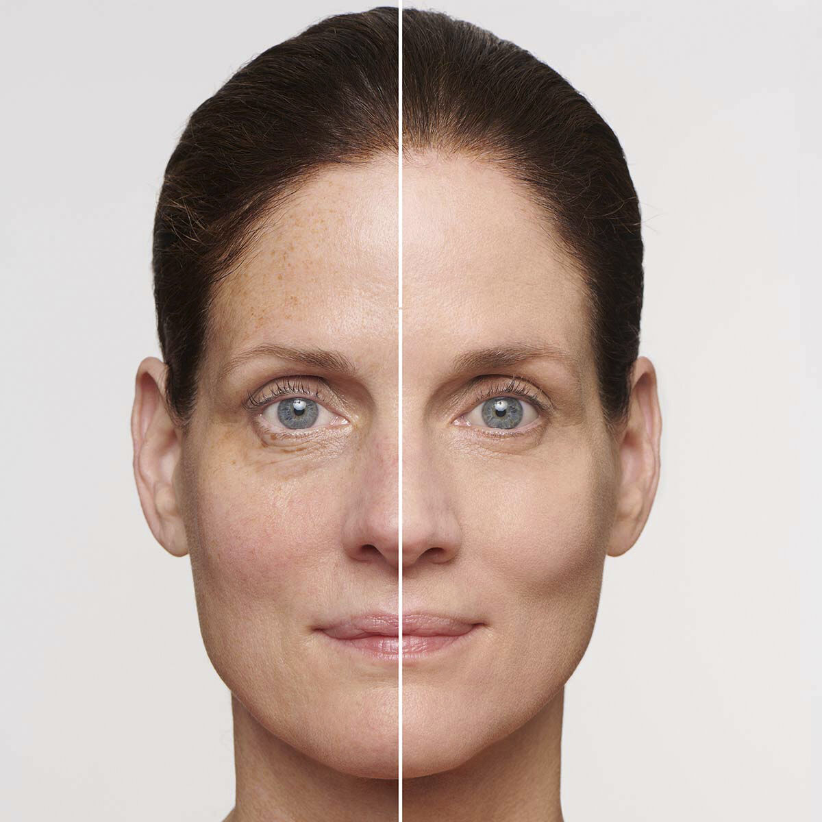 SOS Primer Imperfections