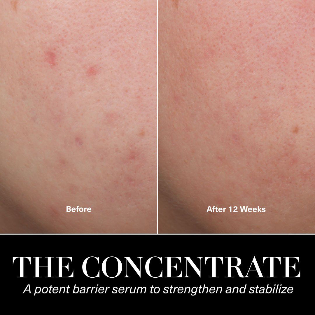The Concentrate Face Serum