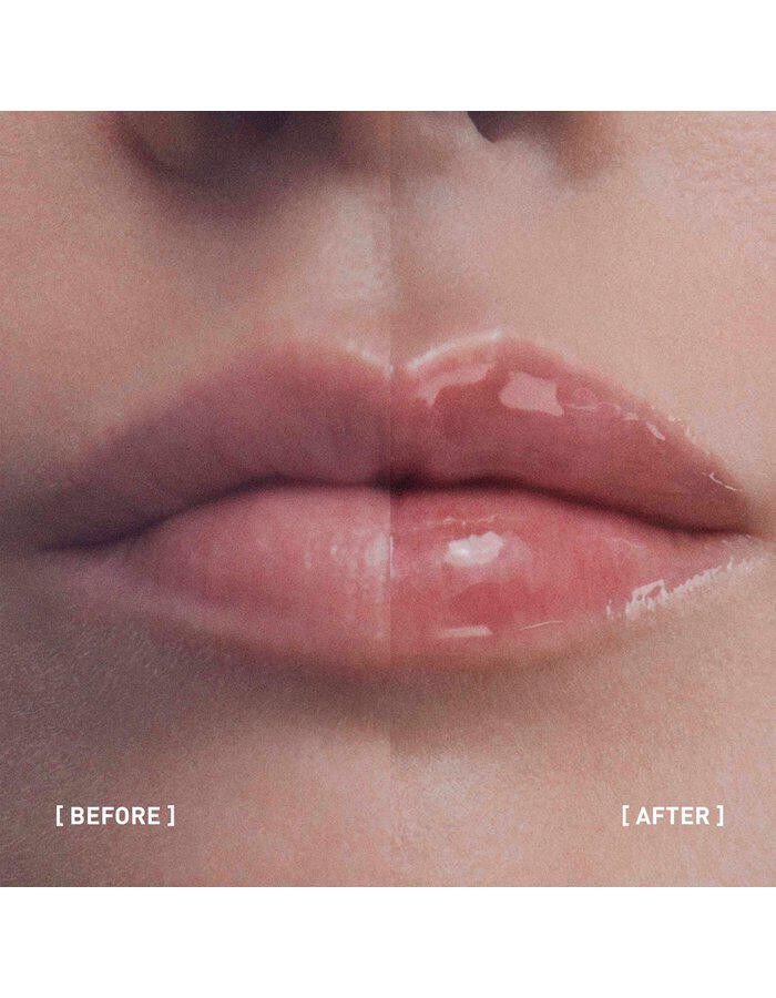 Filorga Hyalu-Filler Lips 4g