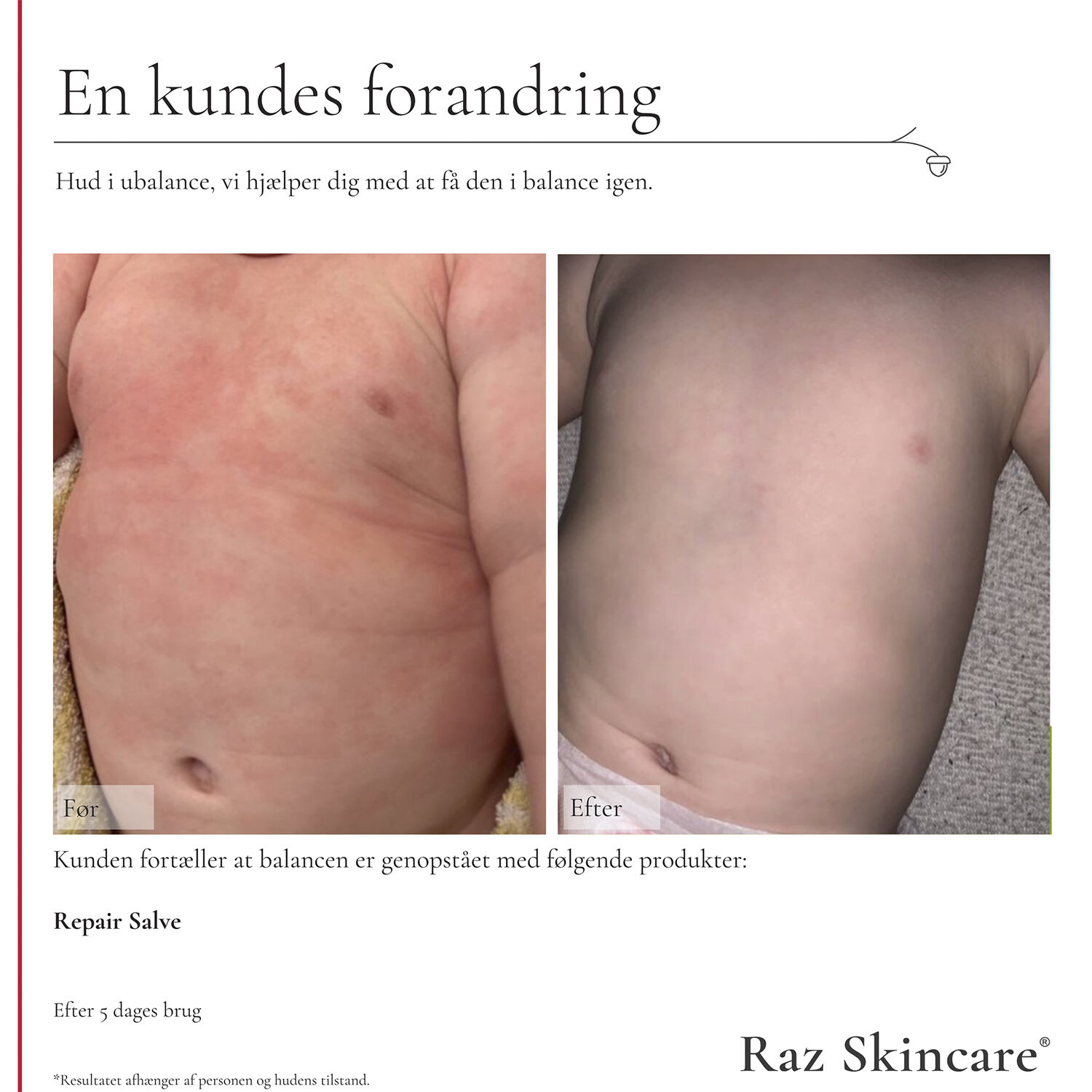 Raz Skincare Repair Salve 100 ml