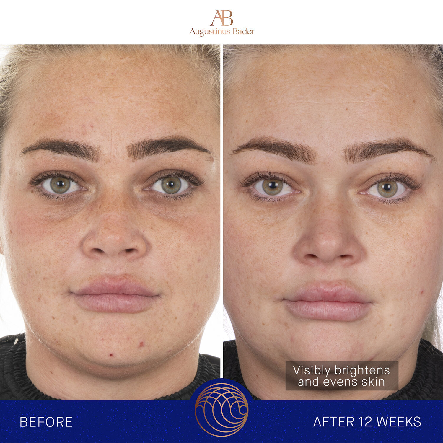 The Face Cream Mask Refill