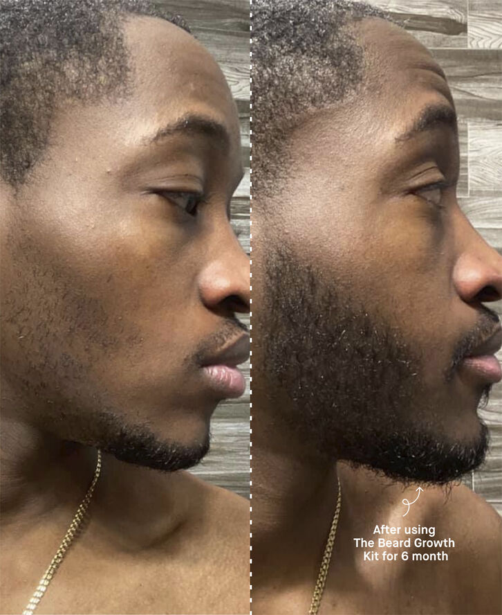 The Beard Growth Kit
