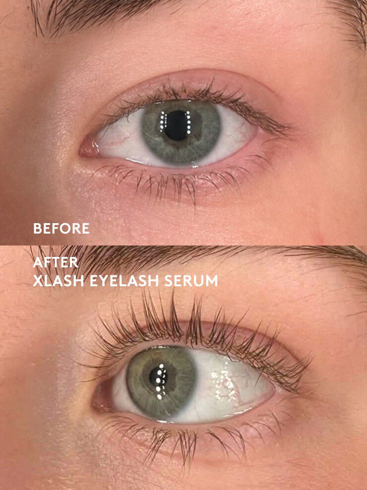Xlash Eyelash Serum 5ml