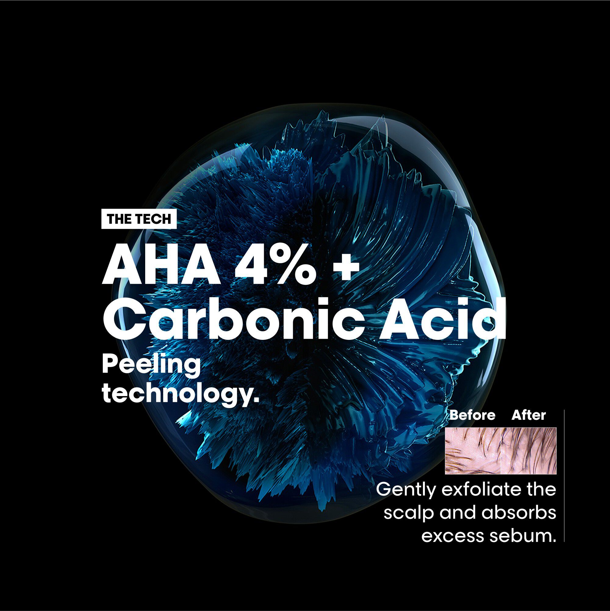 L'Or&eacute;al Professionnel Scalp Advanced Anti-Oiliness Shampoo 300ml