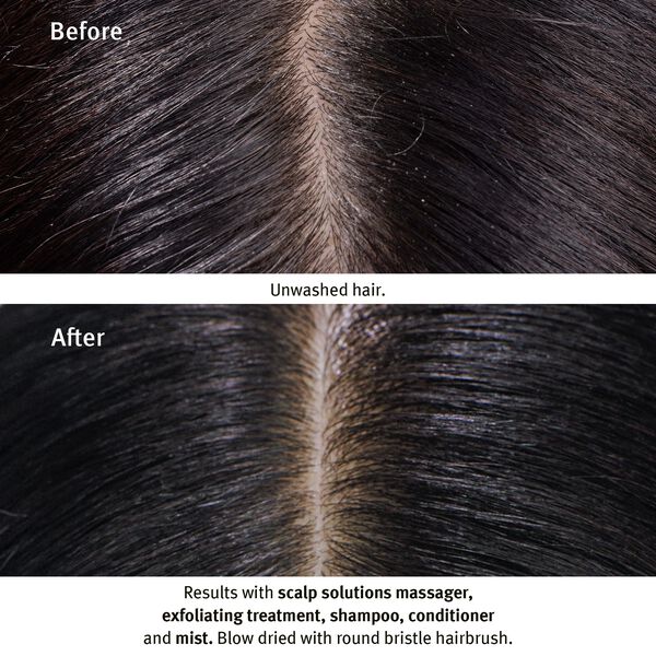 Scalp Solutions Overnight Recovery Serum 50ml