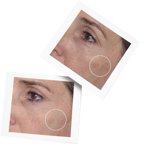 Rapid Dark Spot Correcting Serum