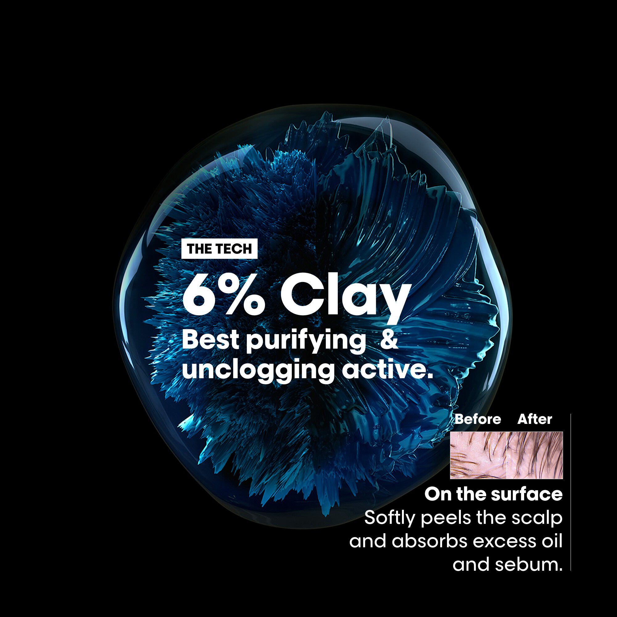 L'Or&eacute;al Professionnel Scalp Advanced Anti-Oiliness 2-in-1 Deep Purifie