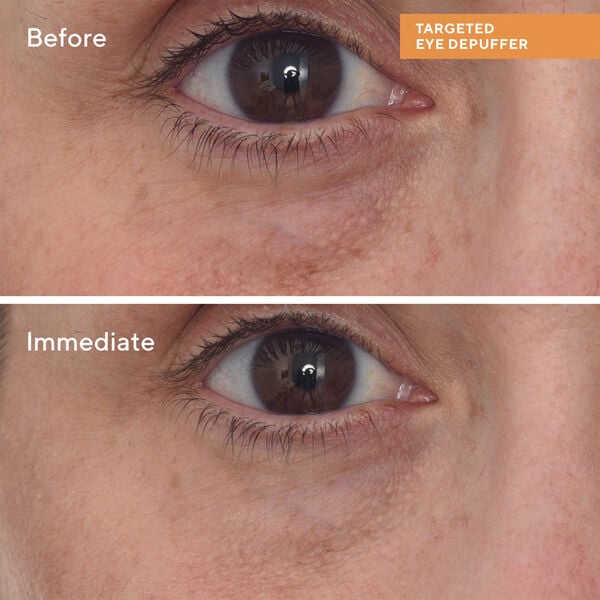 Targeted EyeDepuffer 15 ml