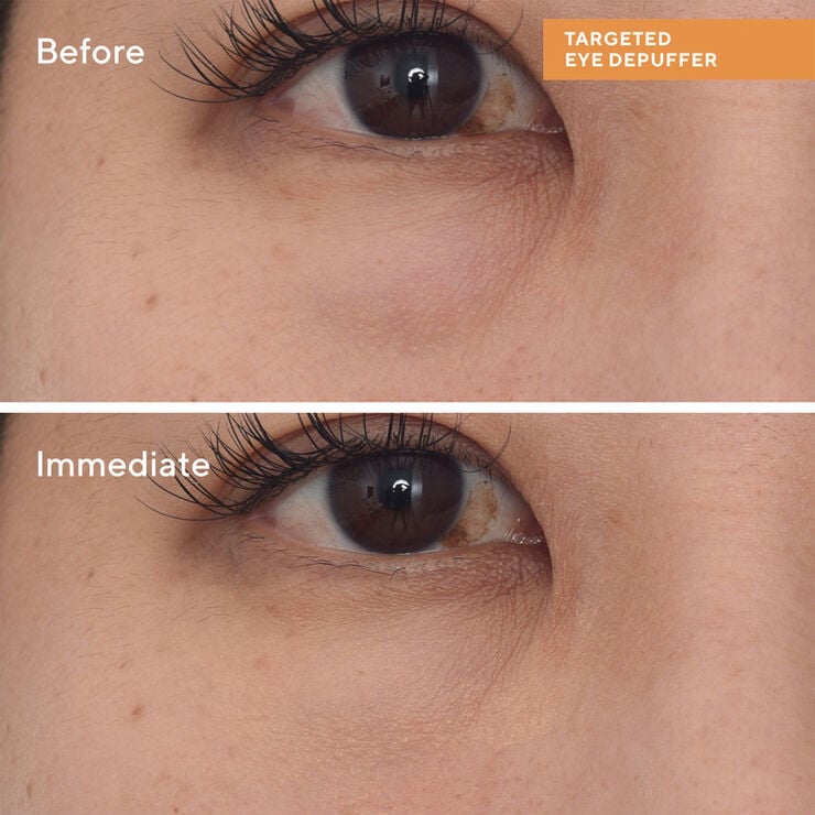 Targeted EyeDepuffer 15 ml