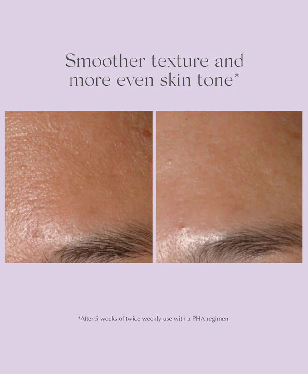 Performance Peel AP 25