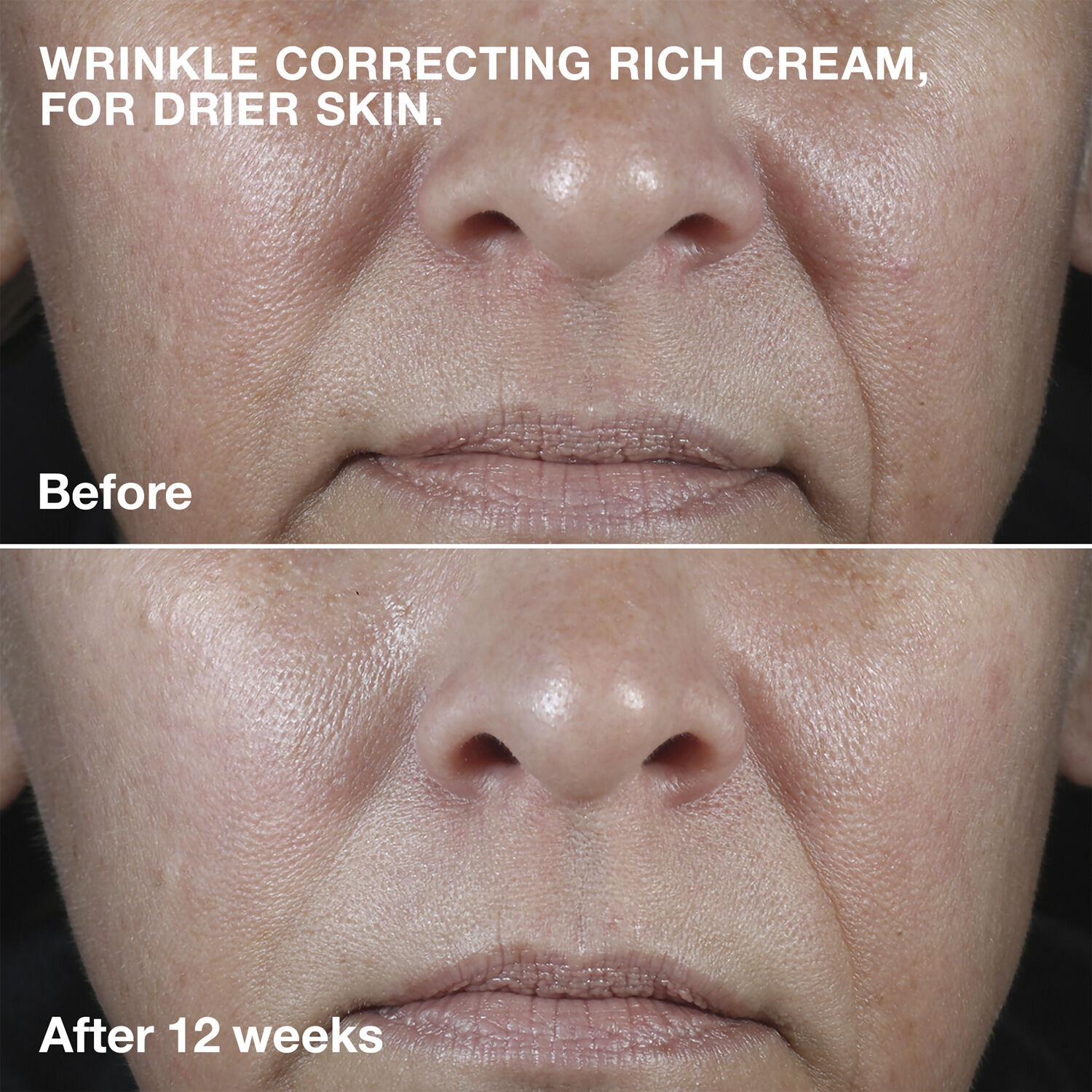 Smart Clinical Repair Wrinkle Face Cream Rich