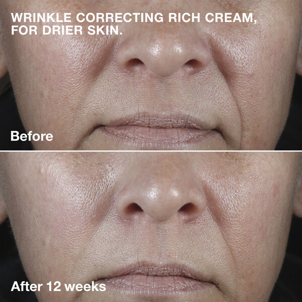 Smart Clinical Repair Wrinkle Face Cream Rich