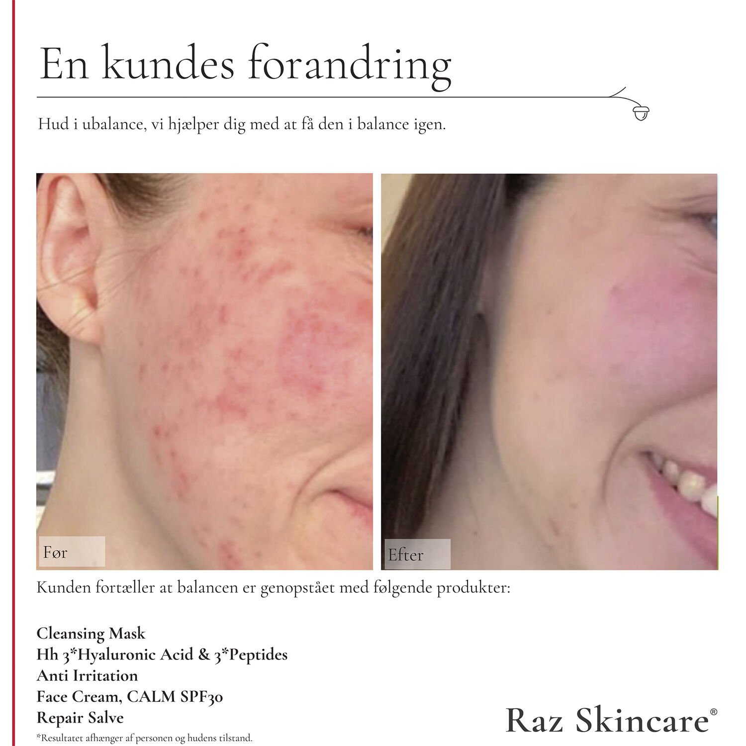 Raz Skincare Face Cream, CALM 50 ml