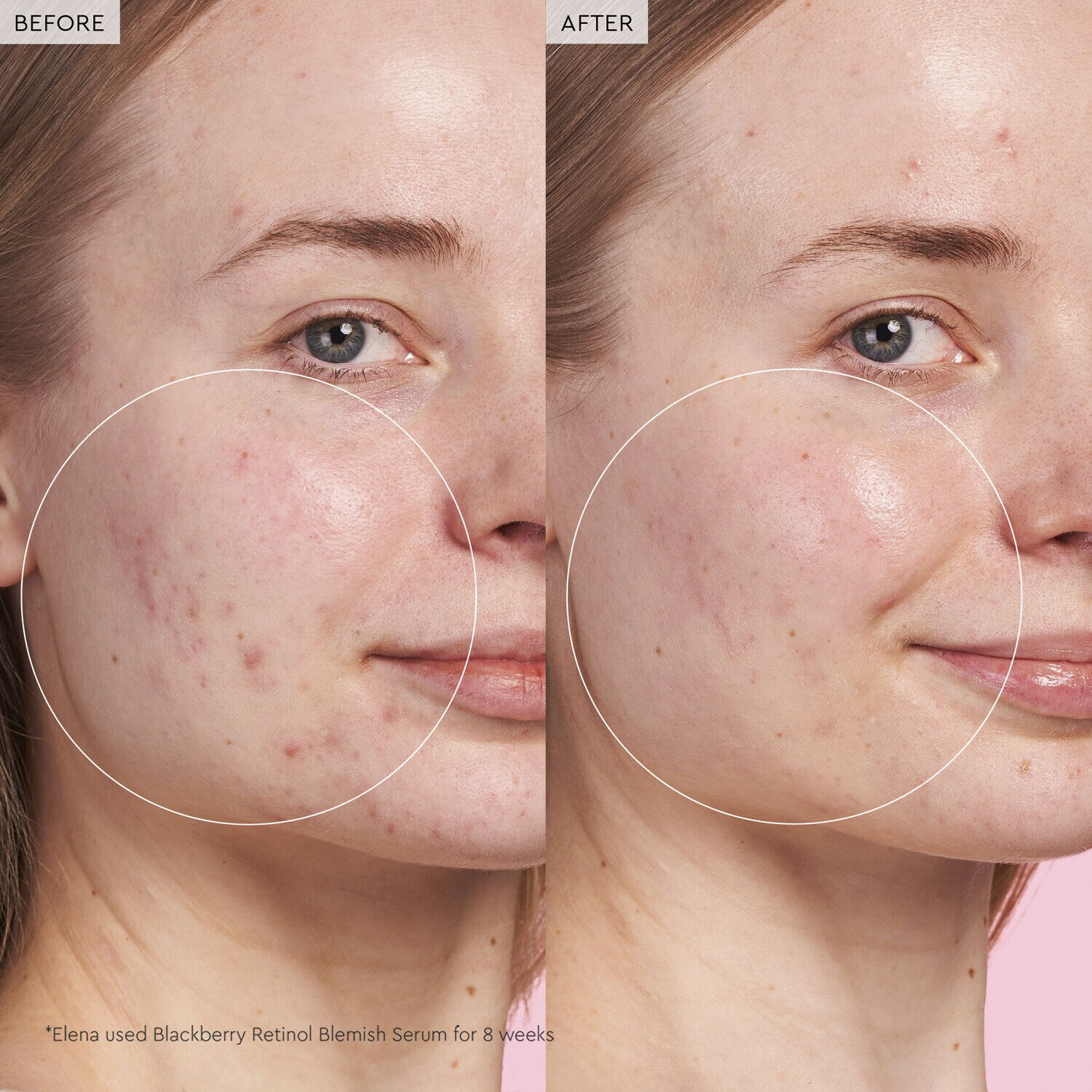 Blackberry Retinol - Reset serum