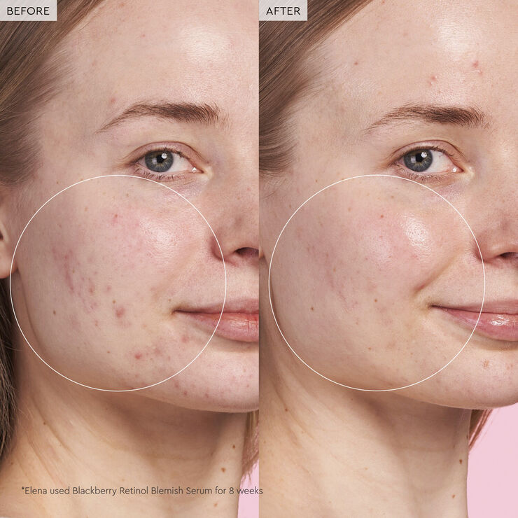 Blackberry Retinol - Reset serum