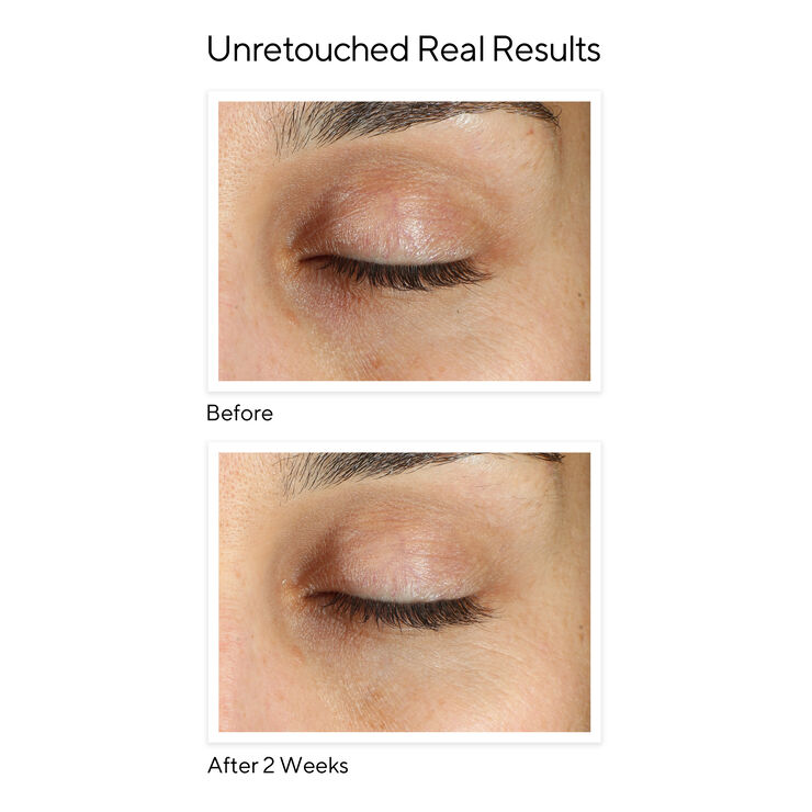 Vita-C Eyes Dark Circle Corrector