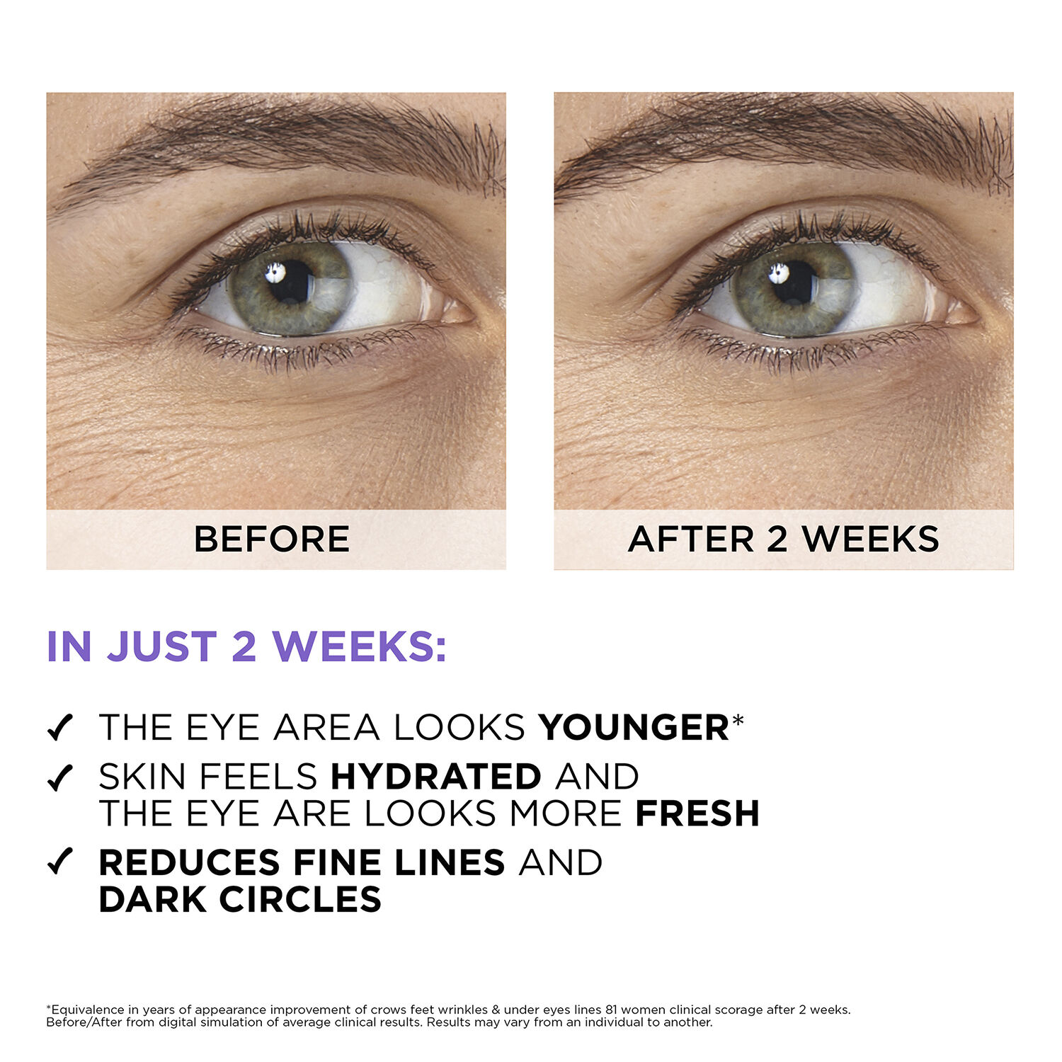 Revitalift Filler 2. 5% Hyaluronic Acid+Caffeine Eye Serum 20ml