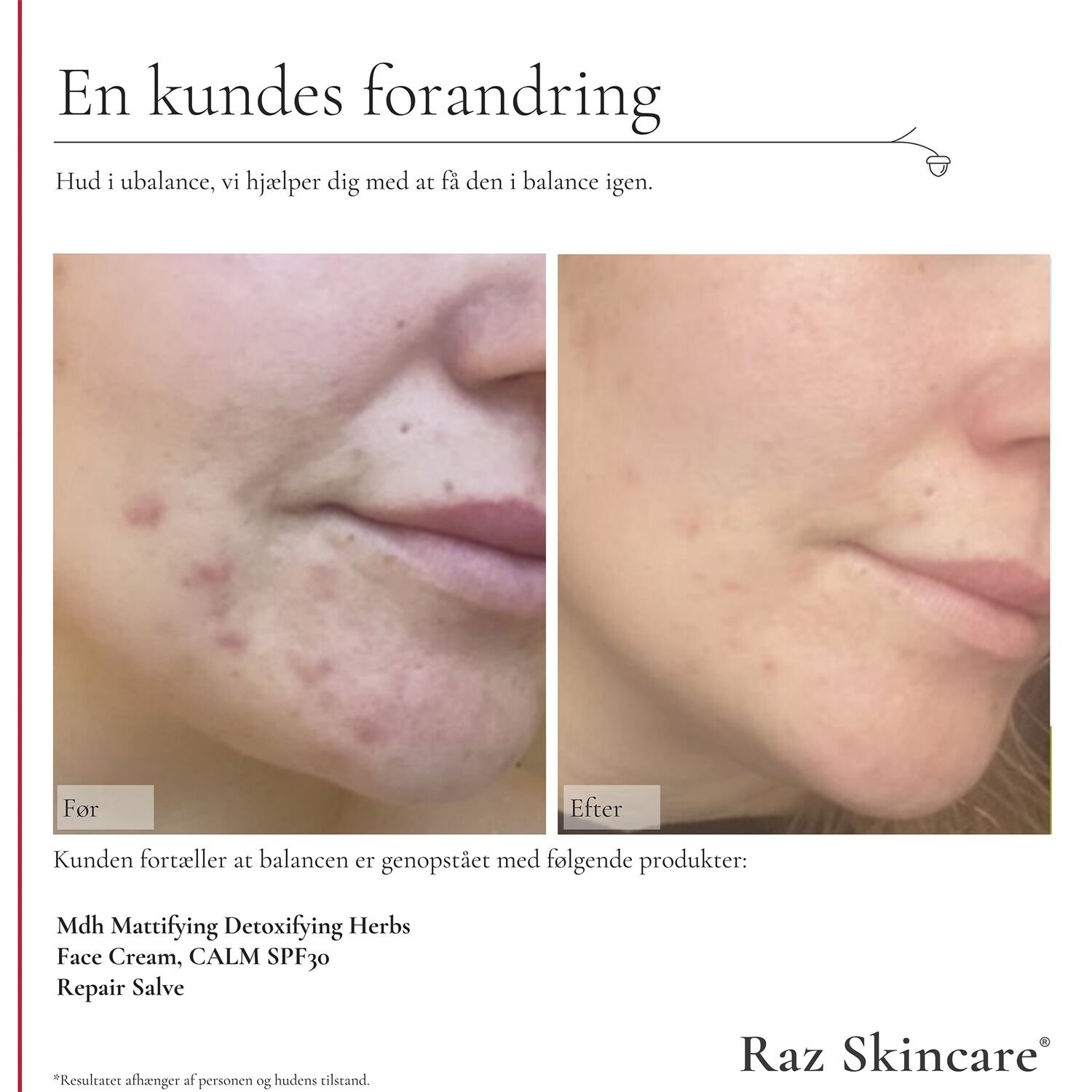 Raz Skincare Repair Salve Perfume Free 15 ml