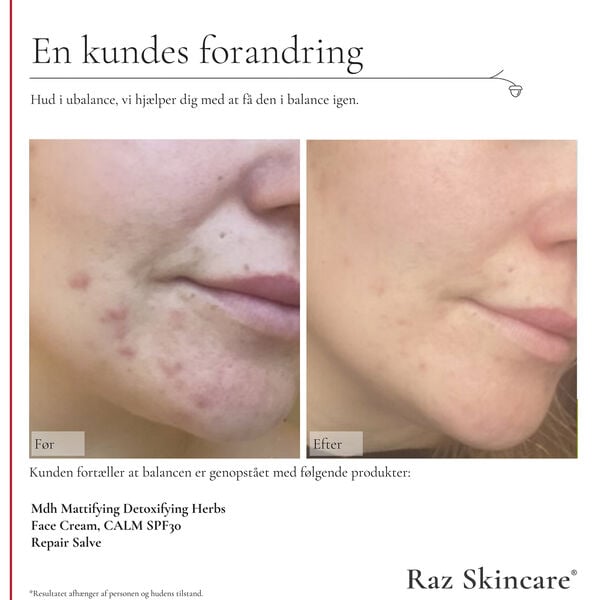 Raz Skincare Repair Salve Perfume Free 15 ml