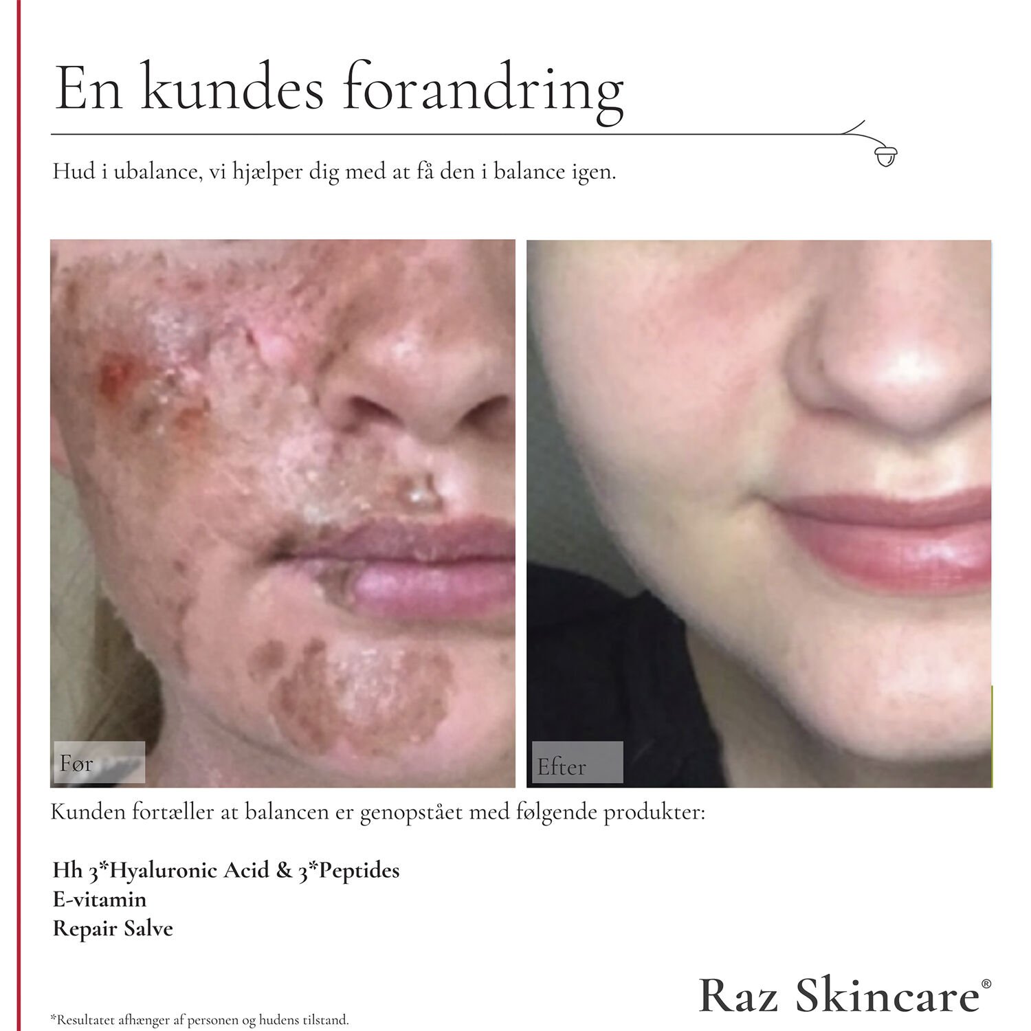 Raz Skincare Repair Salve Perfume Free 15 ml