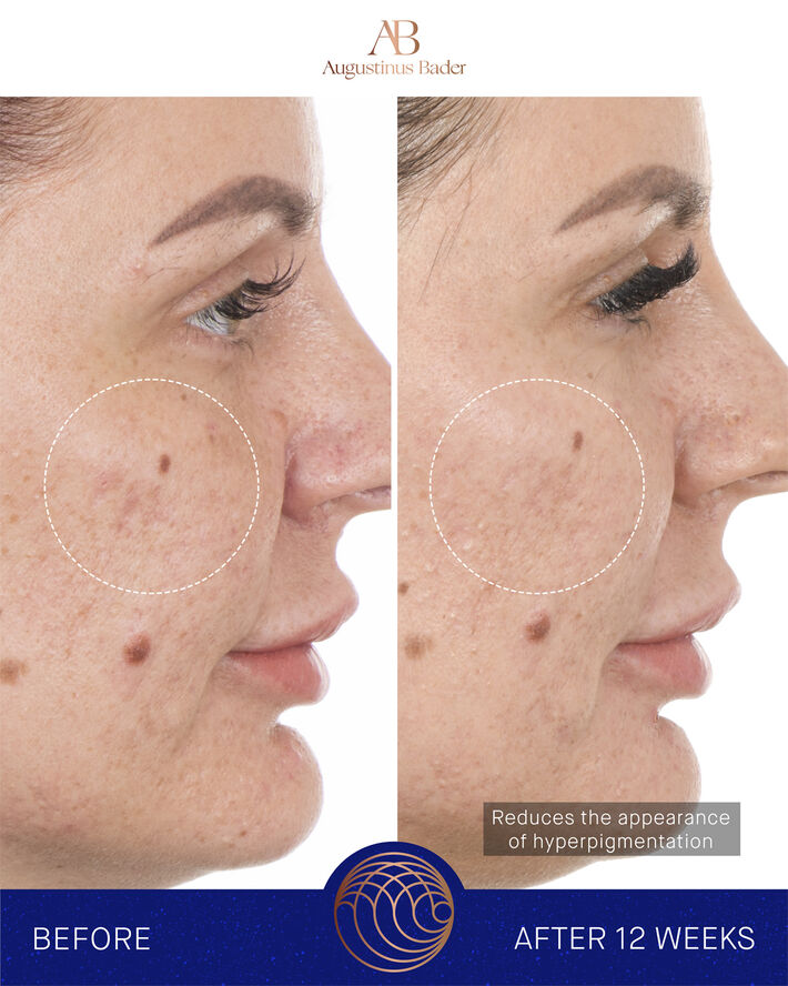 The Retinol Serum 15ml Nomade ROW