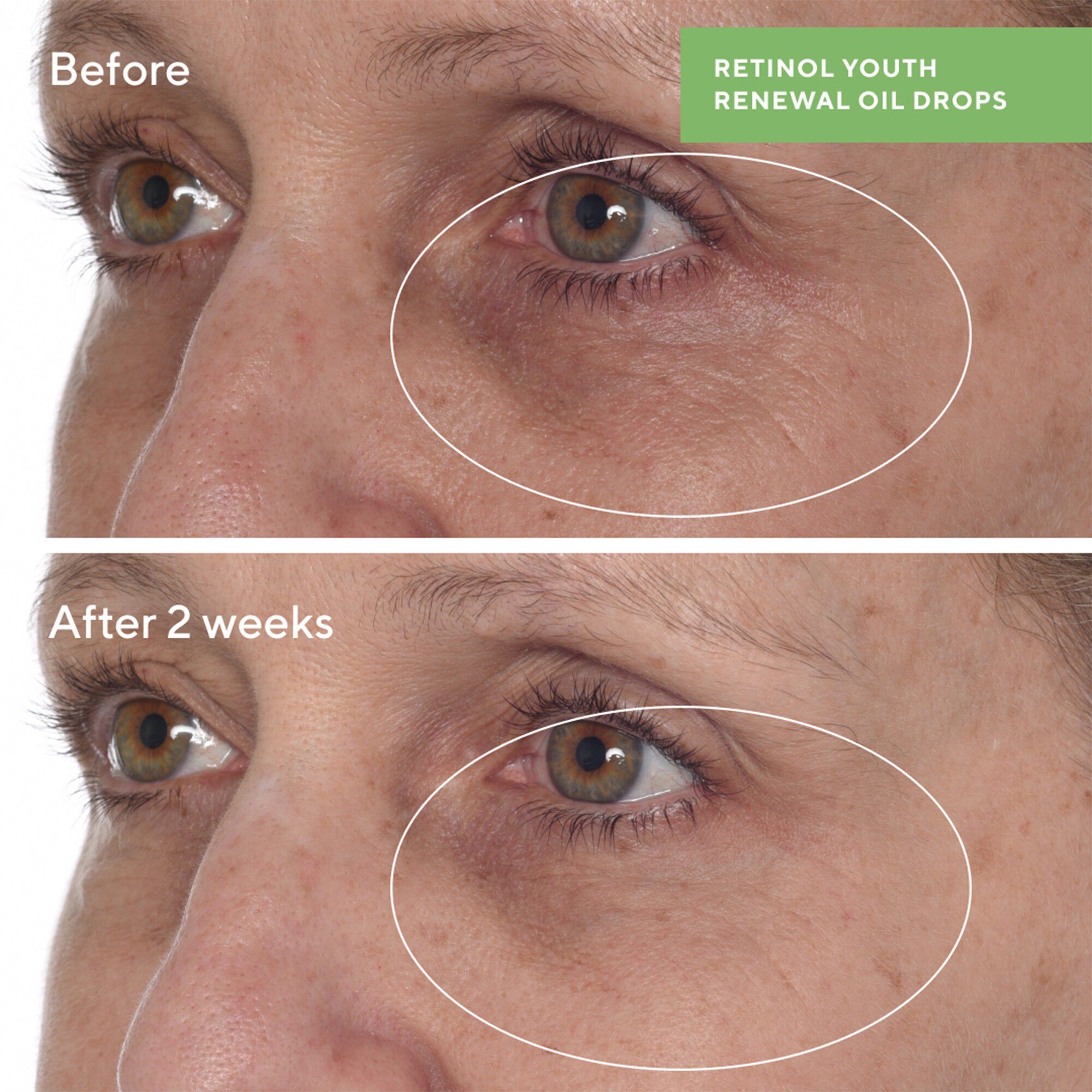 RETINOL YOUTH RENEWAL OIL DROPS 30 ML