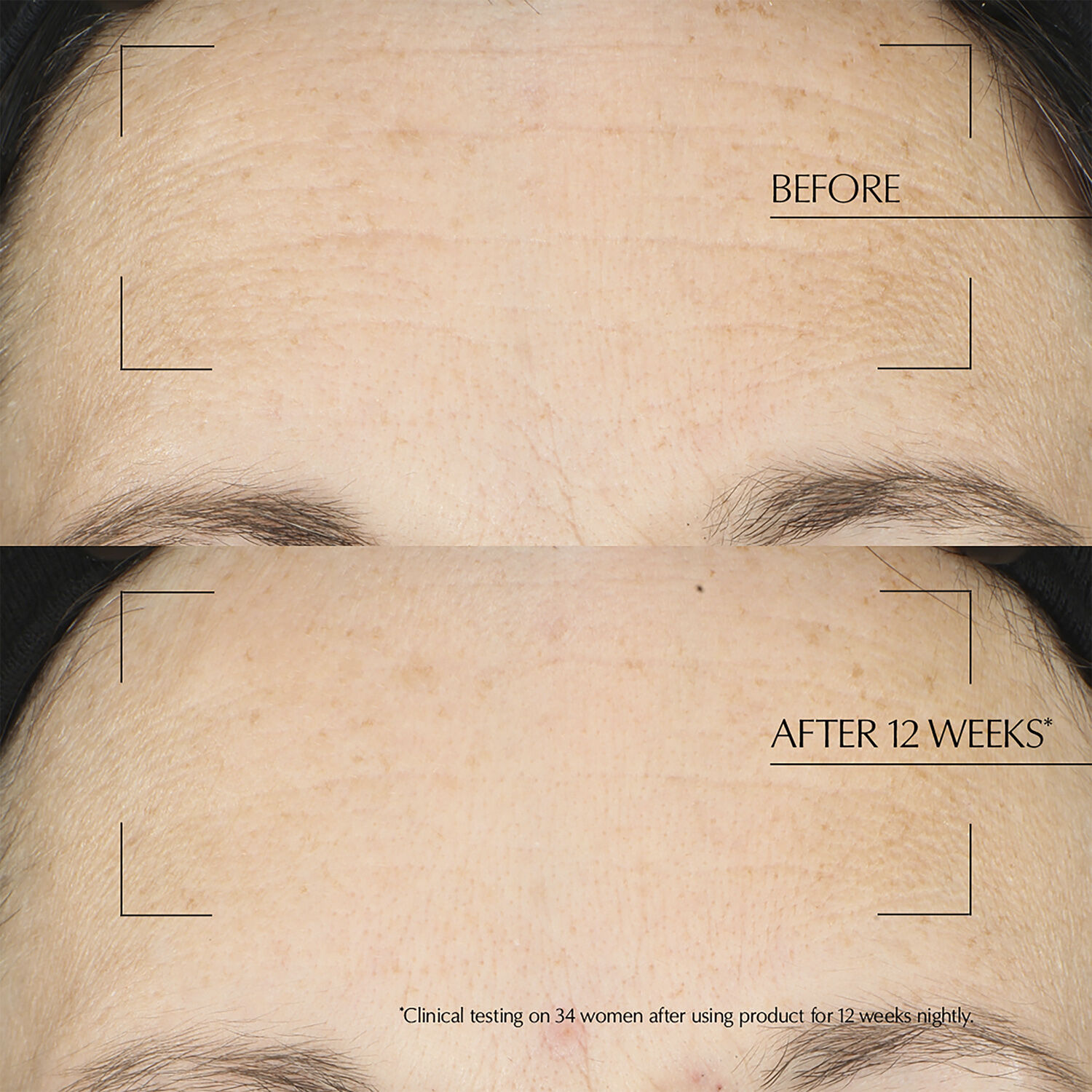 Advanced Night Repair Overnight Treatment Mask