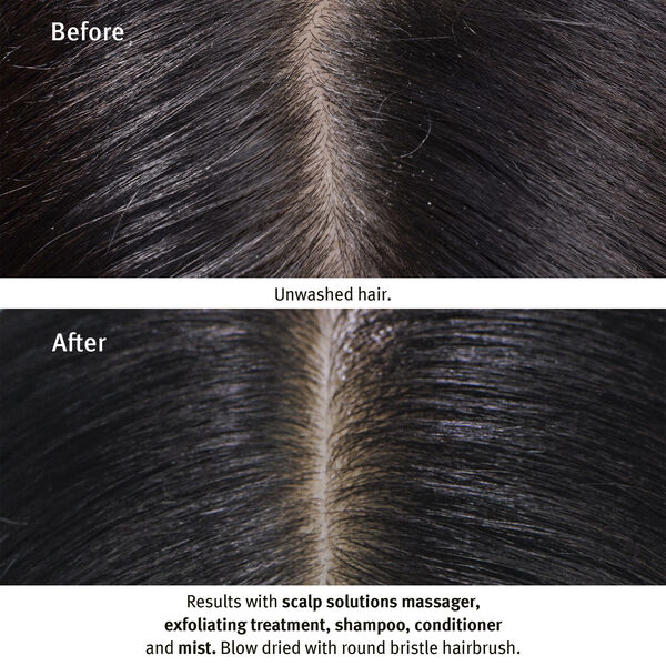 Scalp Solutions Overnight Recovery Serum 50ml