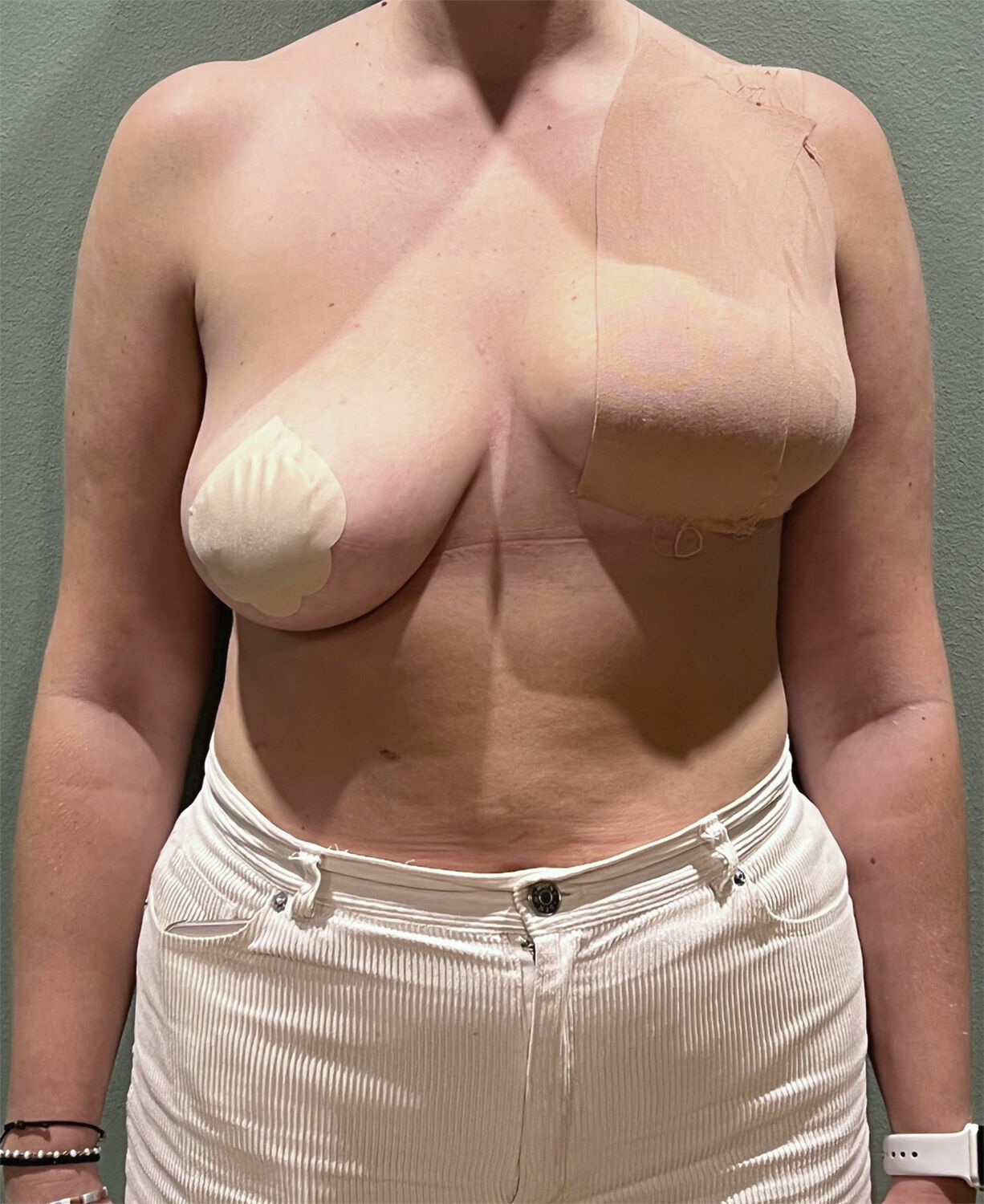 AISO Breast Tape 5cm Cholo