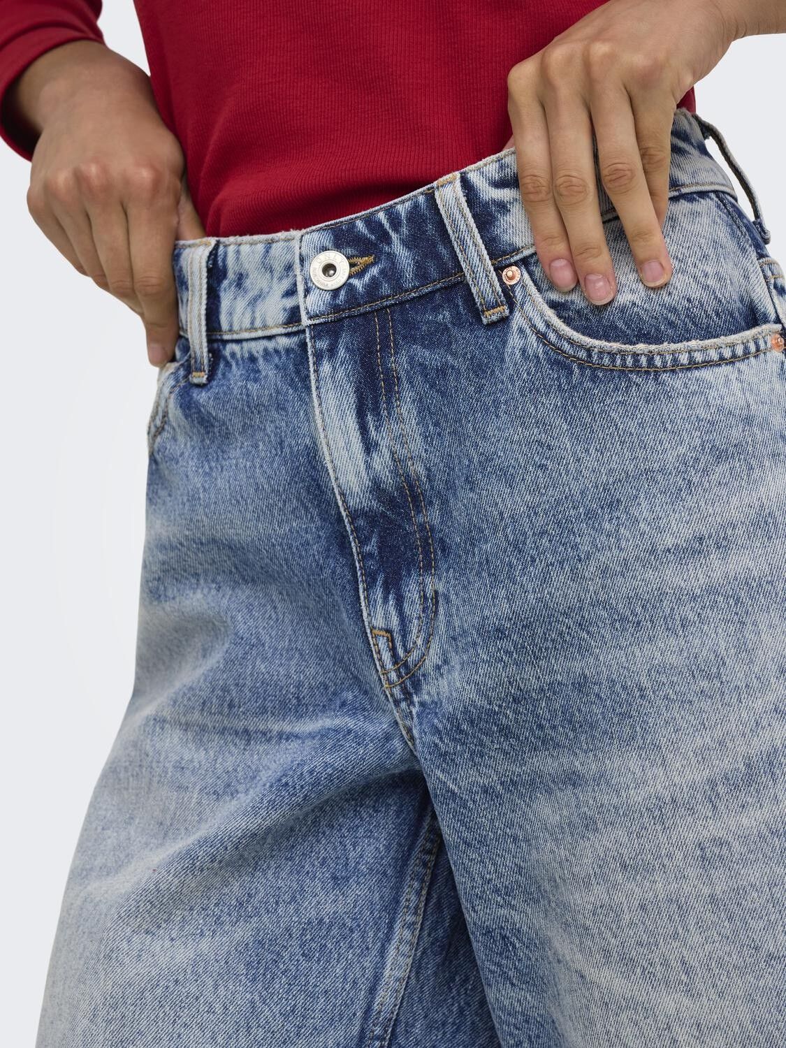 Onltoy Hw Bermuda Shorts Dnm Dot Ka